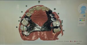 chassis_1