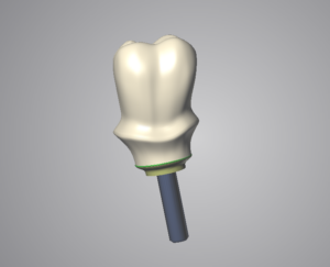 pilier_perso_02