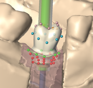 pilier_perso_04