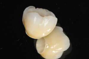 pilier_zircone_6